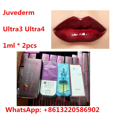 Juvederm-Lippen-ha-Hautfüller mit Lidocaine Ultra3 Ultra4