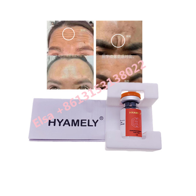 Botulinumgiftstoff Hyamely  eine koreanische Kosmetik  100u schreiben