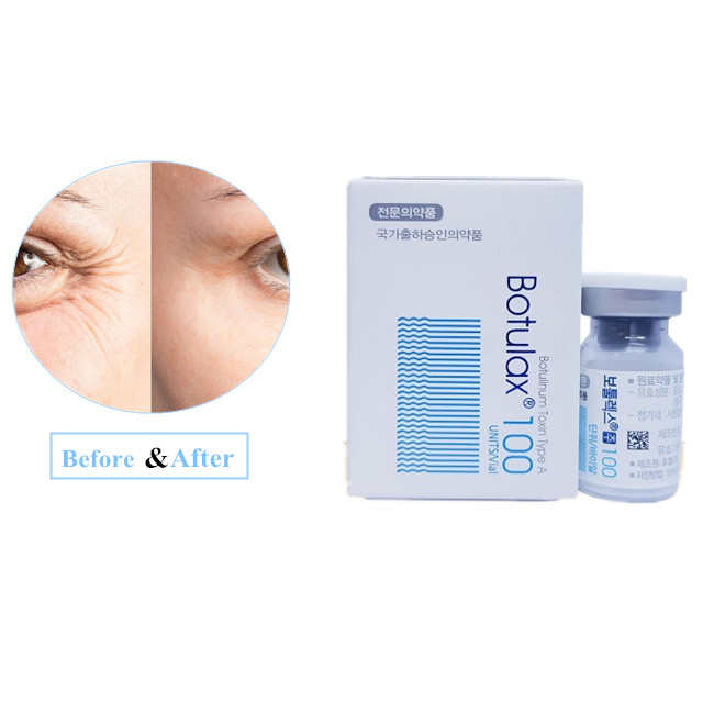 Kroean 100U Botulinumtoxin  Typ A Falten entfernen BTX