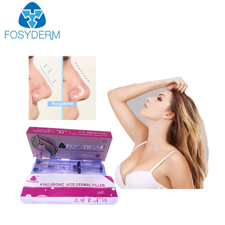 2 ml Hyaluronsäure Hautfüllmittel zur Faltenglättung im Gesicht, Kinn, Wange, Lippen und Körper