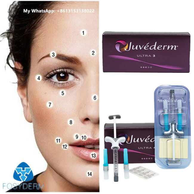 JUVÉDERM Injektionsgel-Füllstoffe Juvederm Hautfiller 2 ml Lipffiller