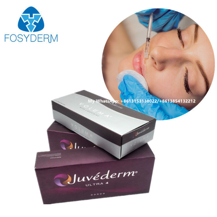 Hyaluronsäure-Dermalfiller Juvederm Ultra 3 Ultra 4 Voluma Injektion