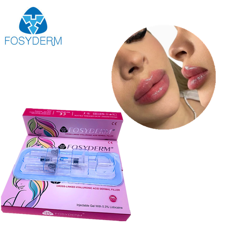 Fosyderm Filler Hyaluronsäure Dermalfiller Injektion für die Lippen 2 ml