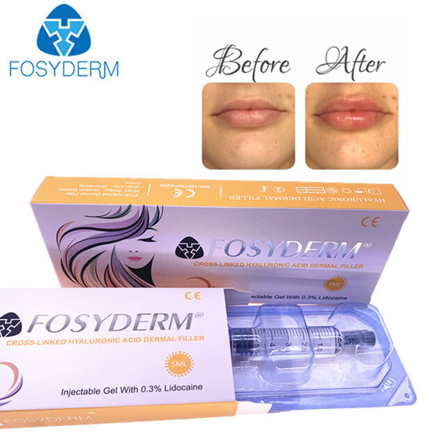 Hyaluronic Acid Dermal Filler Face Lifting 1ml 2ml