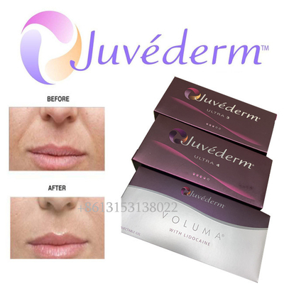 Langlebige Ultra3 Ultra4 Voluma Einspritzung des Juvederm-Hyaluronsäure-Gesichtsfüller-