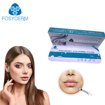 Fosyderm-CER Hyaluronsäure-Kreuz verbundener Hautfüller für Lippen herauf 24mg/Ml