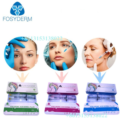 FÜLLER-Hyaluronsäure-Einspritzung 24mg/ml ha Fosyderm Hautfür Lippen-CER