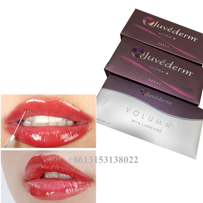 Juvederm Voluma Hyaluronsäure Filler Gel 24mg/Ml Filler für die Haut
