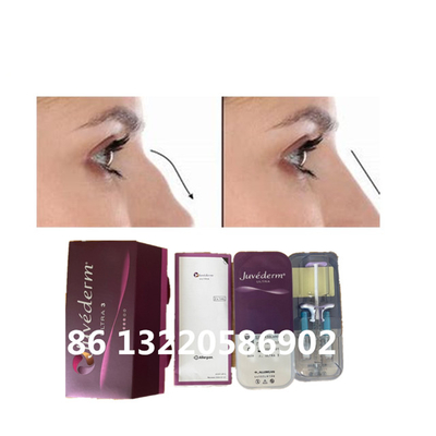 Nasen-Füller-Hyaluronsäure Juvederm Ultra3 Ultra4 Voluma Haut