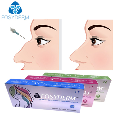 Hyaluronsäure-Hautnasen-Füller-Einspritzung 1ml 2ml für die weibliche Anwendung
