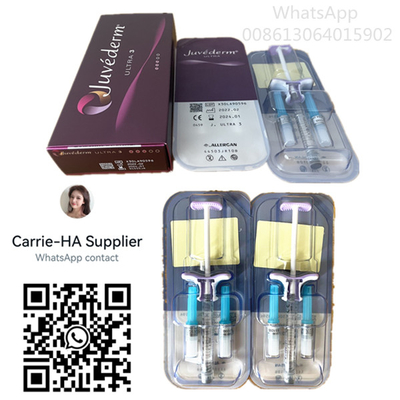 Transparente Lippenfüller Juvederm ultra 3 Juvederm Voluma Haut