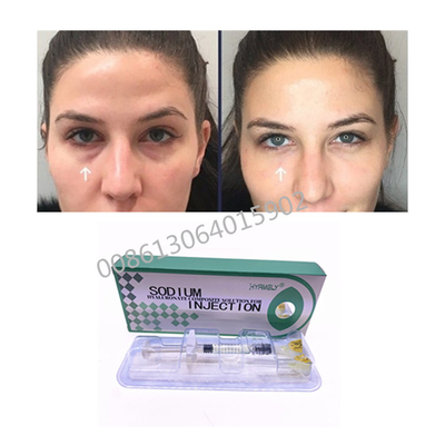 Entfernen Sie Natrium-Hyaluronate der Augenringe-1ml zusammengesetzte Lösung