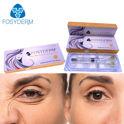 riechen Hautfüller-Einspritzung Hyaluronsäure 5ml Fosyderm für Lippen