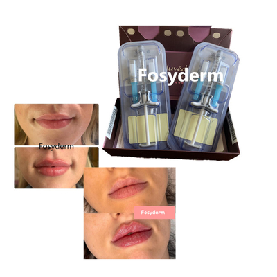 Juvederm-volbella Hyaluronsäure-Lippenfüller-Kreuz verband 24mg