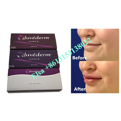 Voluma Hyaluronsäure Fosyderm Hautfüller Injektion 24mg/ml