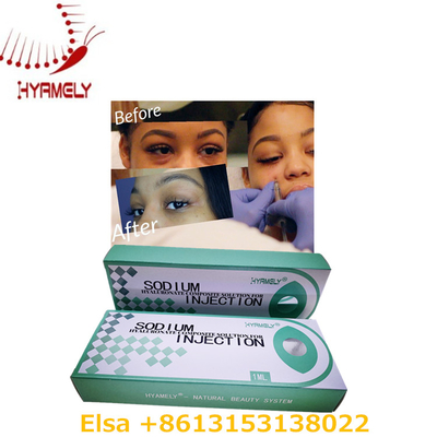 1 ml Natriumhyaluronat-Gel gegen Augenringe gegen Augenringe