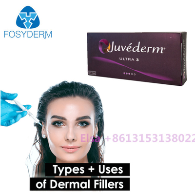 FÜLLER Voluma/ultra Juvederm Hautjuvederm-Spritze mit Lido