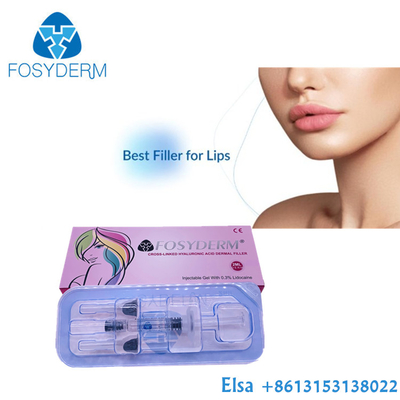 Hautfüller Hyaluronsäure Fosyderm für Gesichts-Lippeneinspritzung 24mg/Ml
