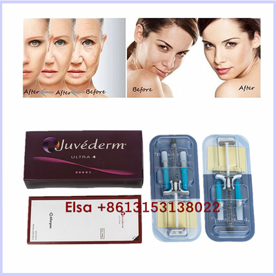 Ästhetische Hyaluronsäure-Hautfüller-Gel-Einspritzung Produkte Juvederm Ultra3 Ultra4 Voluma