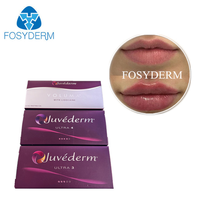 Juvederm Dermal Filler Injektion Kreuzverknüpfte Hyaluronsäure HA Gel Gesichtsfiller Vorfüllspritze