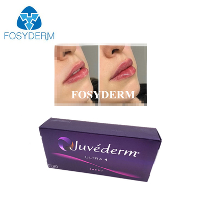 Koreanische Hyaluronsäure Cross Linked Dermal Filler Juvederm Lip Filler Injektionen