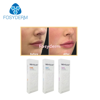 1.1 ml Dermale Lippenfüllmittel Revolax Feine Tiefe Sub-Q für Anti-Falten Hyaluronsäure Injektion