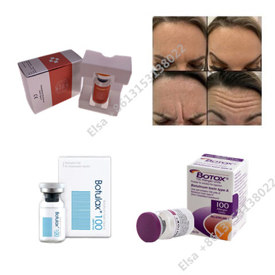 Allergan  Botulinumtoxin Injektionspulver Schönheitsmittel gegen Altersfalten