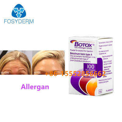 100 Einheiten Botulinumtoxin Allergan Entfernen Gesichtsfalten Injektion  Typ A