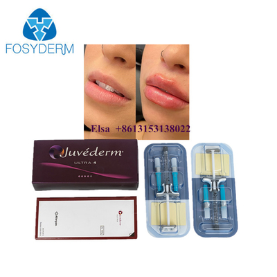 Juvederm Injektionsfiller für die Haut Juvederm Ultra3 Ultra4 Voluma