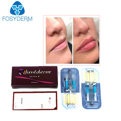 Juvederm Hyaluronsäure Hautfüllmittel gegen Falten Injektion für das Gesicht