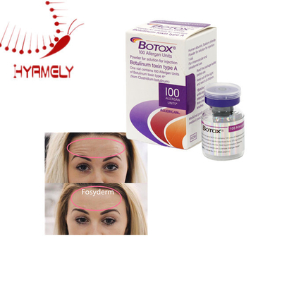 Anti-Falten-Ästhetik Lyophilisiertes Meditoxin Allerganpulver Botulinumtoxin
