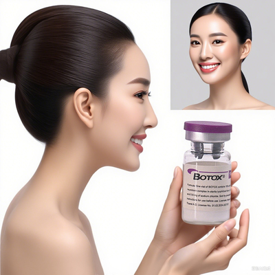 Allergan Injektions Botulinum Toxin Anti- Falten Filler für Gesicht und Hals Faltenreduzierung Lösung