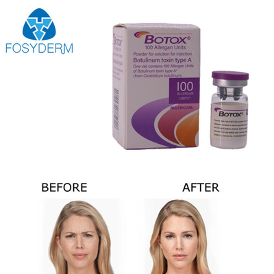 Allergan Botox Injektion 100 Einheiten zur Faltenentfernung