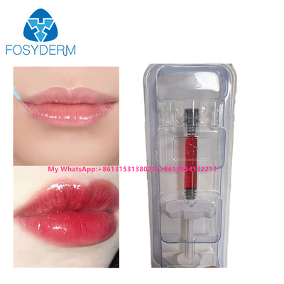 Roter Lippenfiller Hyaluronsäure Dermalfüller Injektion mit Vitamin B12 für Lippen 1ml