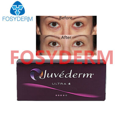 Juvederm Hyaluronsäure Hautfiller für Lippen- und Gesichtslifting 24 mg