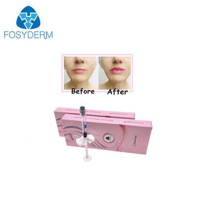 Lippennase Chin-Fülle verband ha-Hyaluronsäure-injizierbaren Füller 24mg/ml quer