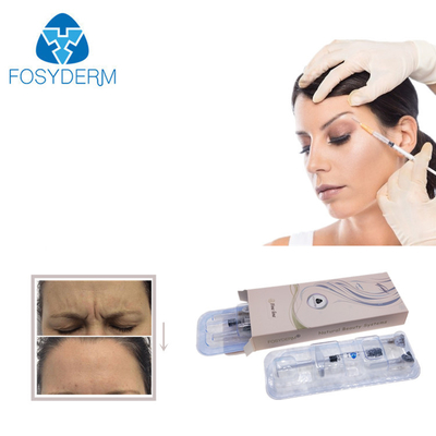 Vor gefüllter querverbundener Lippenfülle Fosyderm-Füller