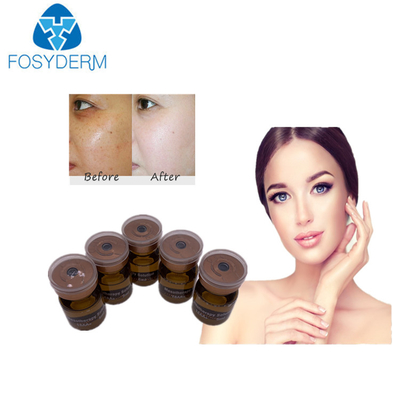 Serum 20mg/ml 5ml Mesotherapy, das Mesolösung weiß wird