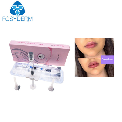 0.28mm ha Hautlippeneinspritzung der füller-Hyaluronsäure-1ml