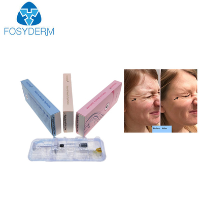 Gel-Kollagen-Hyaluronsäure-injizierbarer Hautfüller