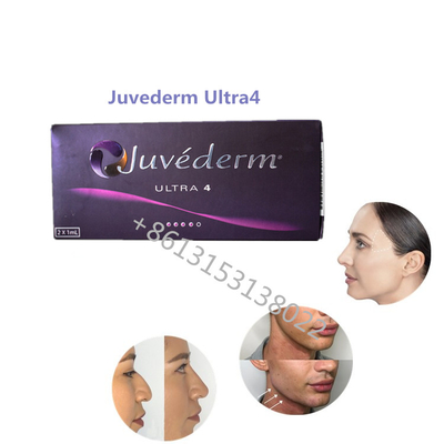 FÜLLER Lippenfülle Juvederm Ultra4 Allergan Hautfüller Juvederm ha für Lippen