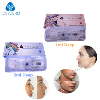 Kreuz verbundener injizierbares Hyaluronsäure-Gel-Hautfüller 1ml 2ml für Lippengesichtshaut