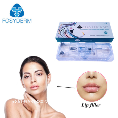 Fosyderm 1 ml Hyaluronsäure Injektionen mit Hautfüllmittel zur Lippenvergrößerung