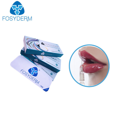 1,1 ml der Derm-Hyaluronsäure-Füller-Lippenverbesserungs-24 mg-mit Lidocaine