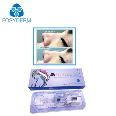 Tiefe Linie von Hyaluronsäure-Hautfüller-Nase 2 ml oben mit Lidocaine