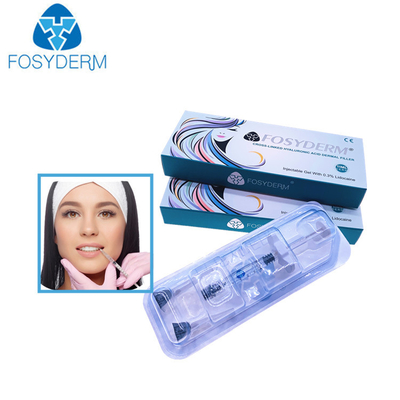 Füller-Hyaluronsäure-injizierbarer Gesichts-Füller 1.1ml Derm Hautlippen