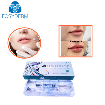 Linie Hyaluronsäure-injizierbare Hautfüller-Lippenverbesserung 1,1 ml Derm