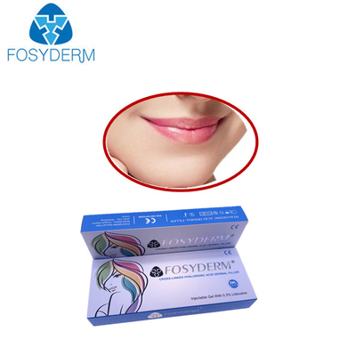 Lächeln zeichnet Hyaluronsäure-Hautfüller-Volumen Derm-Linie Lyft-Lidocaine-Hautfüller