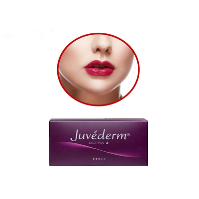 Juvederm ultra 3 Hyaluronsäure-Hautfüller-russische Lippen mit Lidocaine