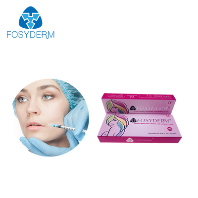 LIPPENfüller-Hyaluronsäure-Einspritzungs-Hautfüller Fosyderm 2ml Haut